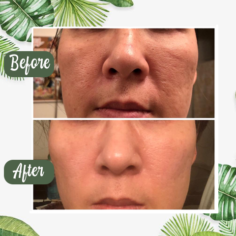 Green Tea Purifying Stick Mask | Deep Clean, Balance Oil & Refresh Skin Naturally (40g)