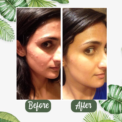 Green Tea Purifying Stick Mask | Deep Clean, Balance Oil & Refresh Skin Naturally (40g)