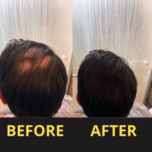 Hairfillup Hair Concealer BLACK 50ML – Waterproof 3–7 days.