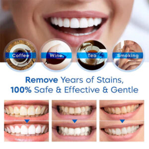 Teeth® Whitening Essence