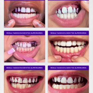 PURPLE STRIPS V34 – Tiras blanqueadoras